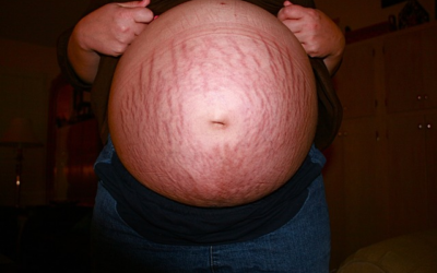 Warum ist mein schwangerer Bauch manchmal hart und manchmal weich?