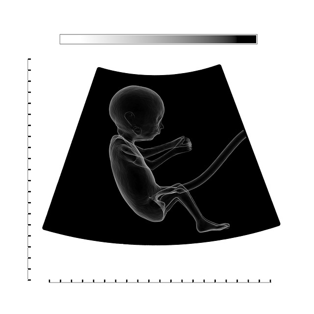 ultrasound, fetus, embryo