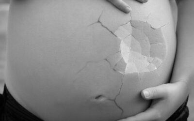 Diagnose Fehlgeburt: Was in dieser traumatischen Zeit zu erwarten ist