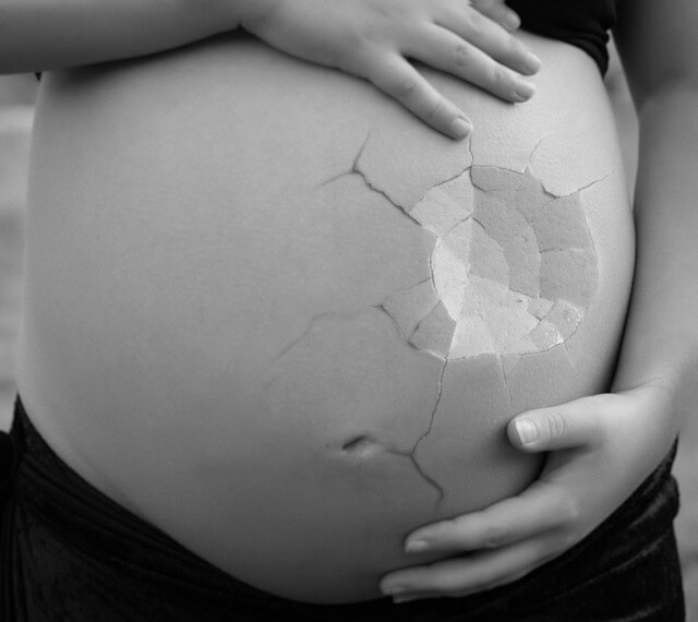 Miscarriages: What to Expect in this Traumatic Experience